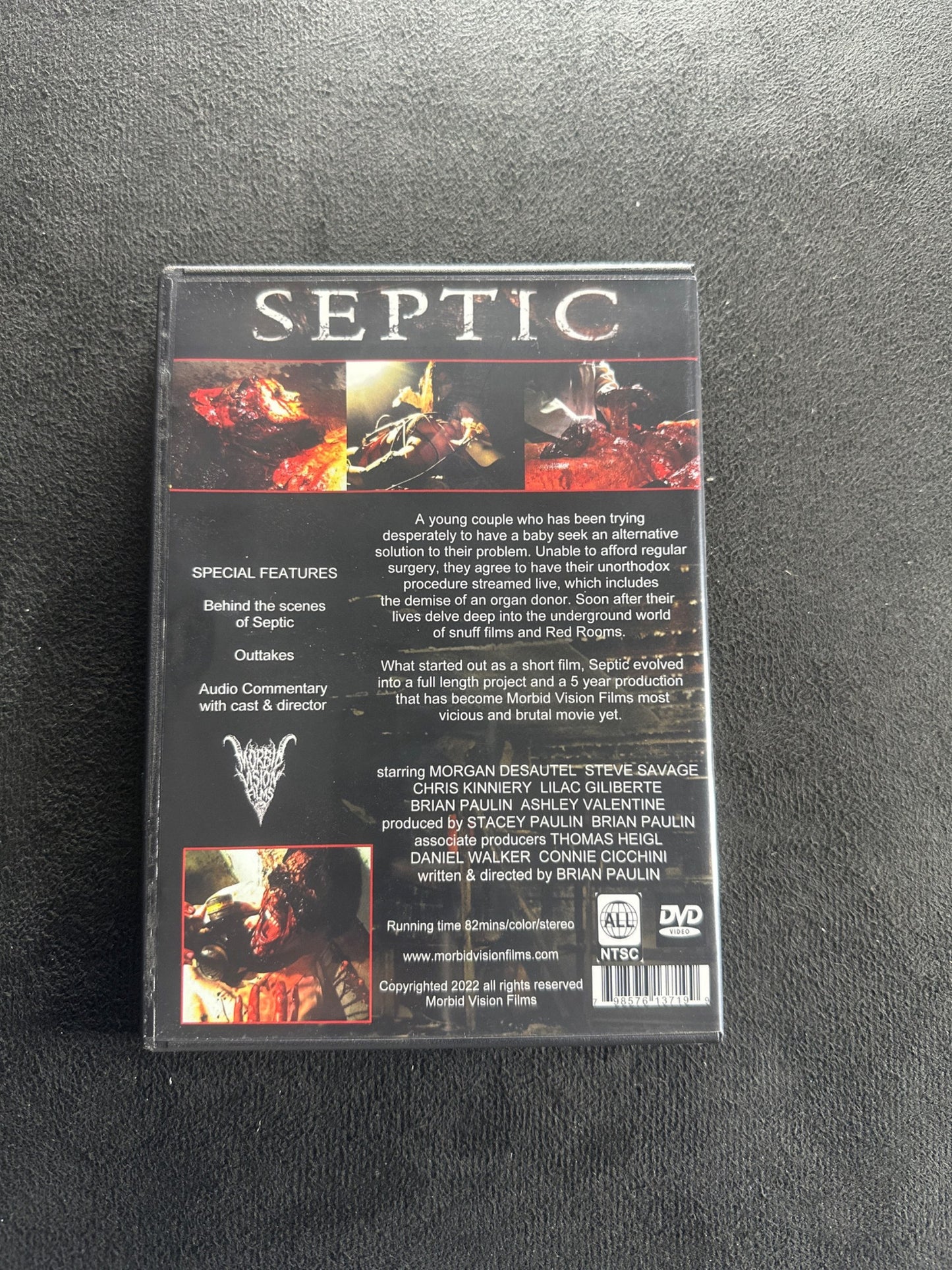 Septic