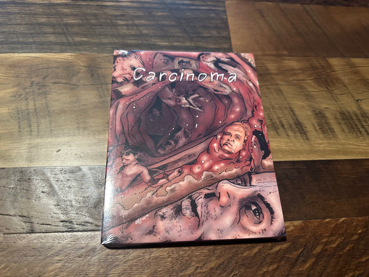Carcinoma Blu ray-Marian Dora Classic-Slipcase-English Subs-NEW