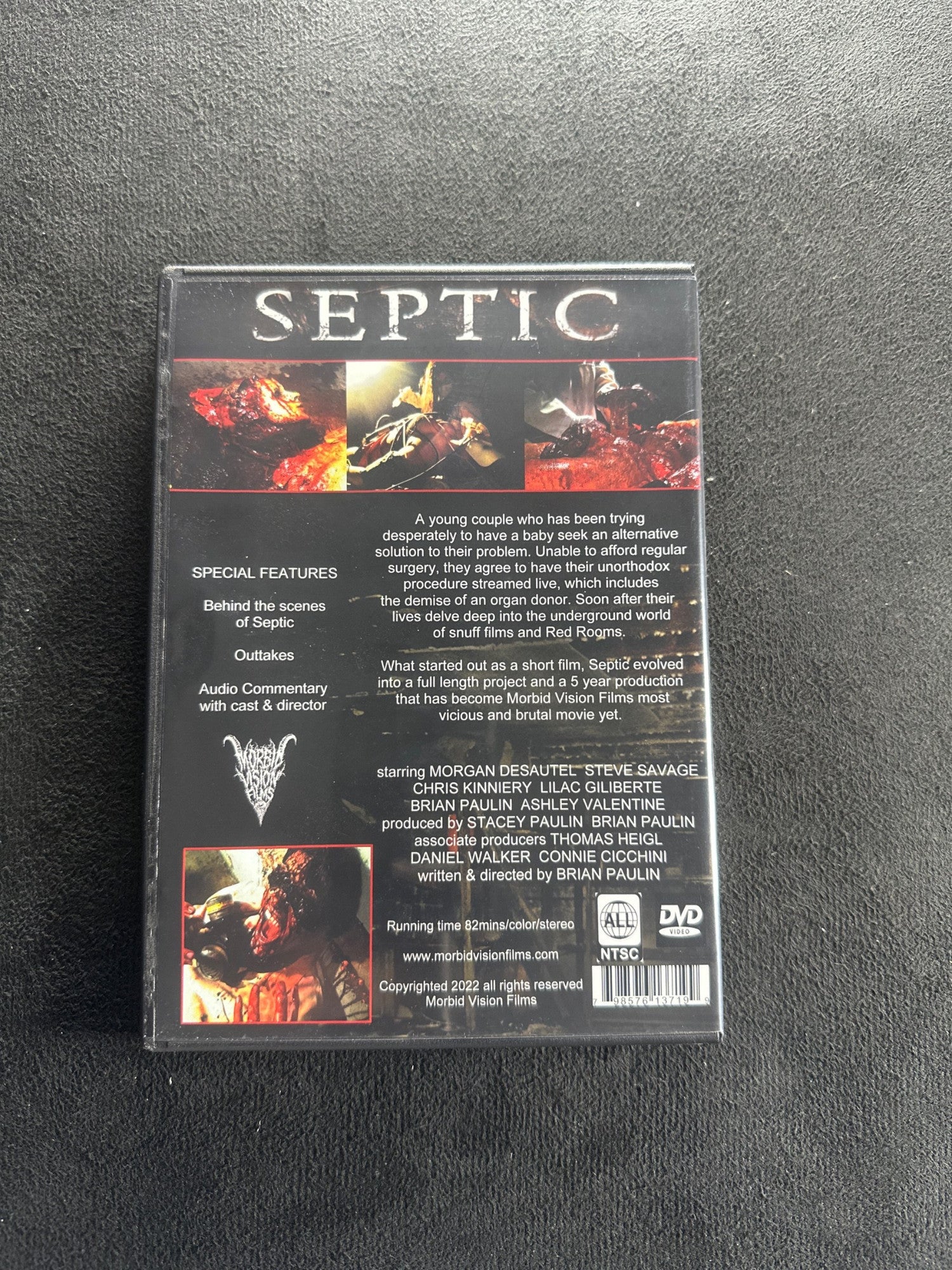 Septic
