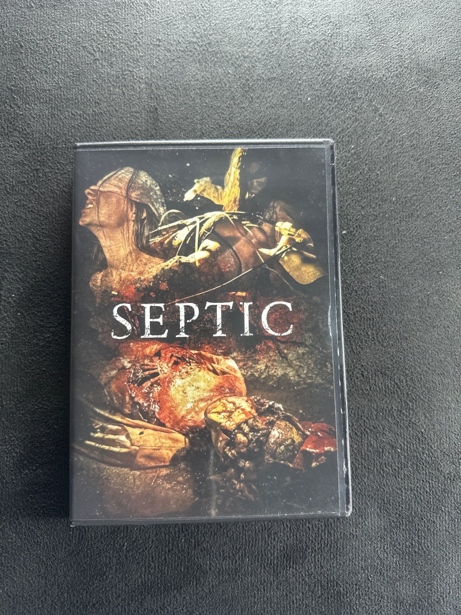 Septic